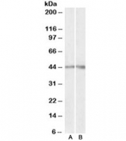 Western blot testing of human [A] and mouse [B] kidney lysates with Podocin antibody at 0.3ug/ml. Predicted molecular weight ~42kDa.