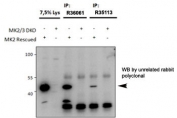 MAPKAPK2 Antibody Immunoprecipitation. Immunoprecipitation analysis using goat polyclonal MAPKAPK2 antibodies Cat. # R36061 and Cat. # R35113 (1.5 ug each) was performed on lysates from MK2/MK3 double knockout mouse embryonic fibroblasts with and without rescued MK2 expression following retroviral transduction. Immunoblot detection with an unrelated rabbit polyclonal antibody identifies a band at approximately 45 kDa selectively in rescued samples, consistent with the predicted molecular weight of MAP kinase-activated protein kinase 2 / MK2 and supporting specific immunoprecipitation of endogenous MAPKAPK2.
