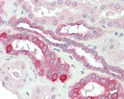 IHC testing of FFPE human kidney tissue with HVEM antibody at 5ug/ml. Required HIER: steamed antigen retrieval with pH6 citrate buffer; AP-staining.