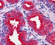 DUSP1 Antibody Human Prostate IHC. IHC staining of FFPE human prostate tissue with DUSP1 antibody demonstrated strong cytoplasmic staining of glandular epithelial cells, consistent with the expression pattern of DUSP1 (Dual Specificity Phosphatase 1), also known as MKP1. DUSP1 is a stress-inducible phosphatase that negatively regulates MAPK signaling by dephosphorylating ERK, JNK, and p38 kinases, thereby controlling cellular proliferation, differentiation, and stress responses. The prominent epithelial staining observed is consistent with the role of DUSP1 in maintaining signaling homeostasis within secretory epithelial tissues. Immunostaining was performed using DUSP1 antibody at 4 ug/ml with an alkaline phosphatase detection system. Heat-induced epitope retrieval was achieved by steaming tissue sections in pH 6 citrate buffer prior to staining. These results support the utility of DUSP1 Antibody for studies of MAPK regulation, signal transduction, cellular stress responses, and prostate biology.