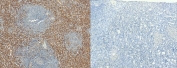 AIF-1 Antibody Spleen Immunohistochemistry. IHC staining of FFPE human spleen tissue with AIF-1 antibody (left) and without AIF-1 antibody (right, negative control). Required HIER: steamed antigen retrieval with pH6 citrate buffer.