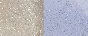 AIF-1 Antibody Frontal Cortex Immunohistochemistry. IHC staining of FFPE human frontal cortex tissue with AIF-1 antibody (left) and without AIF-1 antibody (right, negative control). Required HIER: steamed antigen retrieval with pH6 citrate buffer.
