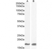 AIF-1 Antibody Mouse and Rat Brain WB. Western blot testing of A) mouse brain and B) rat brain lysate with AIF-1 antibody at 1ug/ml. Predicted molecular weight: ~17 kDa.