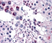 FZD9 Antibody Human Testis IHC. Immunohistochemical staining of FFPE human testis tissue using FZD9 Antibody / Wnt Signaling Receptor Antibody demonstrates distinct AP-red positive staining within subsets of testicular cells. The staining pattern is consistent with expression of FZD9 (Frizzled Class Receptor 9), a cell-surface receptor that mediates Wnt signaling pathways involved in cellular differentiation, proliferation, and developmental regulation. Positive immunoreactivity within the testicular compartment is consistent with the established role of Wnt-Frizzled signaling in reproductive tissue development, germ cell biology, and maintenance of tissue homeostasis. HIER: steamed in pH6 citrate buffer prior to staining. Detection was performed using an alkaline phosphatase (AP) chromogenic method.