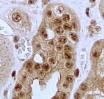 Jagged 1 Antibody Kidney IHC. Immunohistochemistry staining of FFPE human kidney tissue using Jagged 1 Antibody / Notch Signaling Ligand Antibody demonstrates distinct cytoplasmic and membranous HRP-DAB brown staining within renal tubular epithelial cells. The staining pattern is consistent with expression of JAG1, a transmembrane Notch ligand that mediates cell-cell communication and regulates cellular differentiation, tissue maintenance, and developmental signaling pathways. Jagged 1 plays important roles in kidney development, epithelial homeostasis, and Notch pathway activation within renal tissues. HIER was performed by steaming tissue sections in pH 6 citrate buffer prior to immunostaining. The antibody was applied at 2 ug/ml and staining was visualized using an HRP detection system.