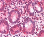 IHC testing of FFPE human small intestine with BAZ2B antibody at 5ug/ml. HIER: steamed with pH6 citrate buffer, AP-staining. Nuclear staining of cells of the lamina propria can be seen.