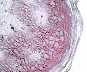 Desmoglein 1 Antibody Human Skin IHC. Immunohistochemistry of Desmoglein 1 antibody in human skin tissue. Formalin-fixed, paraffin-embedded human skin shows strong membranous staining in suprabasal keratinocytes, consistent with Desmoglein 1 localization in desmosomal junctions of stratified squamous epithelium. Heat-induced epitope retrieval was performed by steaming sections in pH 6 citrate buffer prior to staining. The goat polyclonal Desmoglein 1 antibody was applied at 4 ug/ml, and AP-based chromogenic detection reveals distinct cell-cell junction staining along the epidermal layers.