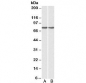 Western blot testing of A) HepG2 and B) MCF7 cell lysate with GRP78 antibody at 0.1ug/ml. Predicted molecular weight: ~73 kDa, but routinely observed at 70-78 kDa.
