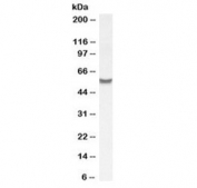 Western blot testing of human placenta lysate with SLC7A6 antibody at 1ug/ml. Predicted molecular weight ~57 kDa.