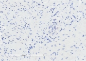 IHC testing of FFPE human colon tissue without GPR120 antibody (negative control). HIER: steam section in pH6 citrate buffer for 20 min.