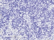 IHC testing of FFPE human lymph node tissue without GLI2 antibody (negative control). HIER: steam section in pH6 citrate buffer for 20 min.