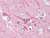 UBR2 Antibody Brain Immunohistochemistry. IHC testing of FFPE human brain (cortex) tissue with UBR2 antibody at 5ug/ml. HIER: steamed antigen retrieval with pH6 citrate buffer; AP-staining.