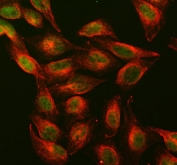 DNMT1 Antibody U-2 OS Cell IF. Immunofluorescence analysis of FFPE human U-2 OS cells using DNMT1 Antibody (green) shows predominant nuclear staining consistent with localization of DNA methyltransferase 1 during epigenetic maintenance. Alpha Tubulin mAb (red) highlights the cytoskeletal network, providing cellular context and contrast. The nuclear enrichment of signal supports DNMT1 function in DNA methylation and chromatin regulation. HIER: steam FFPE sections in pH 6 citrate buffer for 20 min.