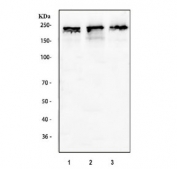 DNMT1 Antibody Multi-Cell Line WB. Western blot analysis of human 1) HeLa, 2) 293T, and 3) SH-SY5Y cell lysates using DNMT1 Antibody detects a band at approximately 180â200 kDa, consistent with the predicted molecular weight of DNMT1 / DNA methyltransferase 1. The strong, high-molecular-weight signal across all three cell lines supports detection of this nuclear maintenance methyltransferase, aligning with its role in preserving DNA methylation patterns during cell proliferation.