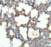 IHC staining of FFPE rat lung tissue with Ace antibody. HIER: boil tissue sections in pH8 EDTA for 20 min and allow to cool before testing.
