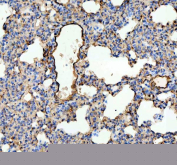 IHC staining of FFPE rat lung tissue with Ace antibody. HIER: boil tissue sections in pH8 EDTA for 20 min and allow to cool before testing.