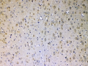 ERBB4 Antibody Rat Brain IHC. Immunohistochemistry testing of FFPE rat brain tissue with ERBB4 antibody at 1ug/ml. Required HIER: steam section in pH6 citrate buffer for 20 min and allow to cool prior to testing.