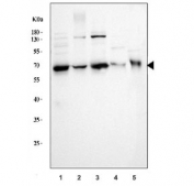 CD5 Antibody for WB. Western blot analysis of CD5 antibody in human Jurkat, human CCRF-CEM, human MOLT-4, rat thymus, and mouse thymus lysates using a T cell signaling regulator antibody at 0.5 ug/ml. Lane 1: human Jurkat lysate, Lane 2: human CCRF-CEM lysate, Lane 3: human MOLT-4 lysate, Lane 4: rat thymus lysate, Lane 5: mouse thymus lysate. A band is detected at approximately 55-67 kDa, consistent with the predicted molecular weight of CD5, with size variation reflecting known glycosylation of this cell surface receptor. Strong signal is observed in T cell-derived lines and thymus tissue, aligning with the established enrichment of CD5 in T lymphocytes.