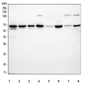 Western blot testing of 1) human SH-SY5Y, 2) human U-251, 3) human U-2 OS, 4) human U-87 MG, 5) rat brain, 6) rat C6, 7) mouse brain and 8) mouse Neuro-2a cell lysate with SOX10 antibody. Expected molecular weight: 50-58 kDa.