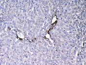 IHC testing of FFPE rat liver tissue with VEGF Receptor 3 antibody at 1ug/ml. Required HIER: steam section in pH6 citrate buffer for 20 min and allow to cool prior to testing.
