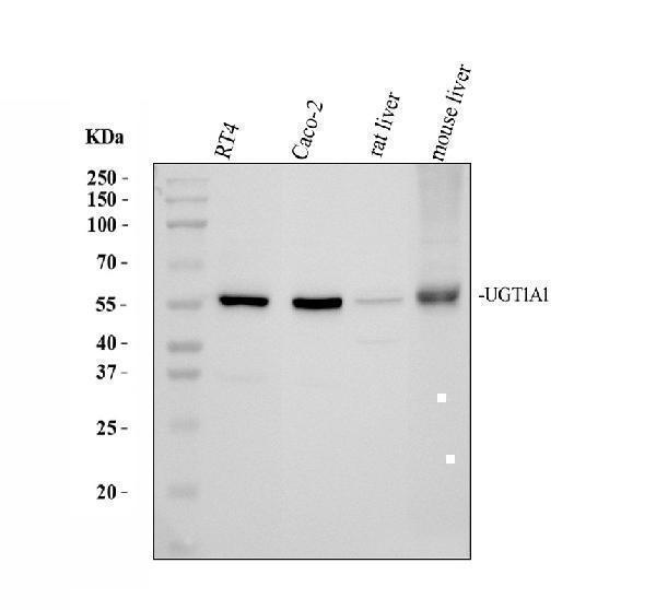 UGT1A1 Antibody / Drug Metabolism Enzyme Antibody Human, Mouse and Rat WB. Western blot analysis of 1) human RT4, 2) human CACO-2, 3) rat liver, and 4) mouse liver lysates using UGT1A1 Antibody / Drug Metabolism Enzyme Antibody. A specific immunoreactive band is detected at approximately 55 kDa in all tested samples, consistent with UGT1A1 expression. The predicted molecular weight of UGT1A1 is approximately 60 kDa. These results demonstrate reliable detection of UGT1A1, a major Phase II metabolic enzyme responsible for bilirubin conjugation, glucuronidation, and the detoxification of endogenous compounds, xenobiotics, and therapeutic drugs.