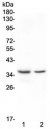 CD8A Antibody for WB - Mouse and Rat Tissue. Western blot analysis of CD8 alpha (CD8A) in 1) rat spleen and 2) rat thymus lysates shows bands at approximately 26-40 kDa, consistent with the predicted molecular weight and glycosylation-dependent migration of this membrane glycoprotein. The signal reflects endogenous CD8A expression in lymphoid tissues enriched for cytotoxic T lymphocytes, supporting use in western blot analysis of rodent immune system samples.