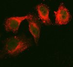 Glycerol Kinase Antibody Human HeLa IF. Immunofluorescent staining of HeLa human cervical cancer cells using Glycerol Kinase Antibody (green) together with an alpha tubulin antibody (red) following enzyme-mediated antigen retrieval. Glycerol kinase displays predominantly cytoplasmic staining with a diffuse to punctate distribution, consistent with its role as a cytosolic enzyme involved in glycerol utilization and lipid metabolism. This result demonstrates the utility of Glycerol Kinase Antibody, a Lipid Metabolism Enzyme Antibody, for investigating glycerol kinase localization, cellular metabolism and energy homeostasis in cultured human cells.