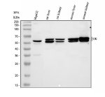 Glycerol Kinase Antibody Human, Mouse and Rat WB. Western blot analysis of Glycerol Kinase Antibody using lysates from lane 1: human HepG2 cells, lane 2: rat liver, lane 3: rat kidney, lane 4: mouse liver and lane 5: mouse kidney. Specific bands are detected at approximately 57-61 kDa, consistent with the expected molecular weight of endogenous glycerol kinase. The closely spaced doublet likely reflects alternative isoforms and/or post-translationally modified forms of the protein. These results demonstrate cross-species detection of glycerol kinase in metabolically active tissues and support the use of Glycerol Kinase Antibody, a Lipid Metabolism Enzyme Antibody, for studies of glycerol metabolism, hepatic function and energy homeostasis.