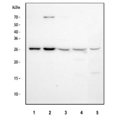 Western blot testing of 1) human HeLa, 2) human MCF7, 3) human SiHa, 4) human ThP-1 and 5) mouse testis tissue lysate with GSTM3 antibody at 0.5ug/ml. Predicted molecular weight ~26 kDa.