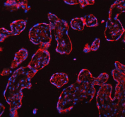 Immunofluorescent staining of FFPE human placental tissue with DYNLT1 antibody (red) and DAPI nuclear stain (blue). HIER: steam section in pH8 EDTA buffer for 20 min.