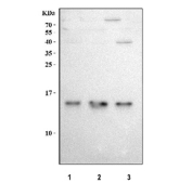 Western blot testing of human 1) SiHa, 2) U-251 and 3) SH-SY5Y cell lysate with DYNLT1 antibody at 0.5ug/ml. Predicted molecular weight ~12 kDa.