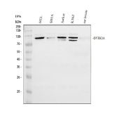 Western blot analysis of DYRK1A using anti-DYRK1A antibody. Proteins were separated on a 10% SDS-PAGE gel under reducing conditions and transferred to a nitrocellulose membrane. Lane 1: human HeLa whole cell lysates; Lane 2: human SiHa whole cell lysates; Lane 3: human Jurkat whole cell lysates; Lane 4: human K562 whole cell lysates; Lane 5: rat brain tissue lysates. The membrane was incubated with rabbit anti-DYRK1A antibody followed by HRP-conjugated goat anti-rabbit IgG and chemiluminescent detection. A specific band was detected at the predicted molecular weight of DYRK1A (~86 kDa). In some cell lysate samples, a closely migrating doublet is observed near the expected size, which is consistent with reported DYRK1A isoforms and phosphorylation-dependent mobility shifts described in the literature.