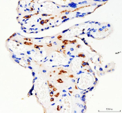 IHC staining of FFPE human placental tissue with DC-SIGN antibody, HRP-secondary and DAB substrate. HIER: boil tissue sections in pH8 EDTA for 20 min and allow to cool before testing.