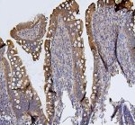 SDHB Antibody Rat Small Intestine IHC. IHC staining of FFPE rat small intestine tissue was performed with SDHB Antibody at 2 ug/ml overnight at 4oC. Heat-induced epitope retrieval was performed in pH 8.0 EDTA buffer, followed by HRP-conjugated secondary antibody and DAB detection. Positive SDHB staining is observed prominently in the intestinal epithelium with a predominantly cytoplasmic pattern. This SDHB Antibody demonstrates localization of the Complex II iron-sulfur subunit in rat small intestine tissue.