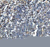 Immunohistochemical staining of FFPE human tonsil tissue with VCAM1 antibody, HRP-secondary and DAB substrate. HIER: boil tissue sections in pH8 EDTA for 20 min and allow to cool before testing.