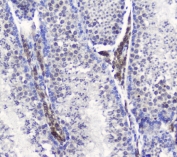 IHC staining of FFPE mouse testis tissue with SMC6 antibody at 1ug/ml. HIER: boil tissue sections in pH6, 10mM citrate buffer, for 10-20 min and allow to cool before testing.