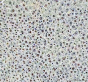 IHC staining of FFPE mouse liver tissue with DCK antibody. HIER: boil tissue sections in pH8 EDTA for 20 min and allow to cool before testing.