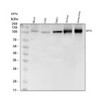 DPYD Antibody Human, Mouse and Rat Liver WB. Western blot testing of human SKOV3 (lane 1), U251 (lane 2), THP-1 (lane 3), rat liver (lane 4), and mouse liver (lane 5) lysates using DPYD antibody detected a specific band at approximately 111 kDa, consistent with the expected molecular weight of dihydropyrimidine dehydrogenase. The strongest signals were observed in rat and mouse liver, in agreement with the well-established high hepatic expression of DPYD, the rate-limiting enzyme responsible for pyrimidine and fluoropyrimidine catabolism. This DPYD Antibody, also called a DPD Antibody, is useful for investigating pyrimidine metabolism, fluoropyrimidine metabolism, chemotherapy response, and cancer pharmacology.
