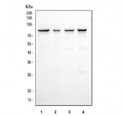 CD2AP Antibody / Cytoskeletal Adapter Protein Antibody Human Cell Line WB. Western blot analysis of 1) human Jurkat, 2) human A431, 3) human HeLa, and 4) human K562 cell lysates using CD2AP Antibody / Cytoskeletal Adapter Protein Antibody. A specific immunoreactive band is detected at approximately 71-80 kDa in all four cell lines, consistent with the predicted molecular weight range of CD2AP. These results demonstrate reliable detection of CD2AP, a multifunctional adaptor protein that links membrane receptors to the actin cytoskeleton and regulates cell adhesion, receptor endocytosis, and intracellular signaling.