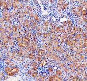 CD2AP Antibody / Cytoskeletal Adapter Protein Antibody Mouse Kidney IHC. Immunohistochemical staining of FFPE mouse kidney tissue using CD2AP Antibody / Cytoskeletal Adapter Protein Antibody. CD2AP expression is detected predominantly in glomerular podocytes and renal tubular epithelial cells, consistent with its established role in maintaining the slit diaphragm, regulating actin cytoskeletal organization, and supporting glomerular filtration barrier integrity. Heat-induced epitope retrieval was performed in pH 8.0 EDTA buffer prior to staining. Immunoreactivity was visualized using an HRP/DAB detection system.