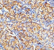 CD2AP Antibody / Cytoskeletal Adapter Protein Antibody Rat Kidney IHC. Immunohistochemical staining of FFPE rat kidney tissue using CD2AP Antibody / Cytoskeletal Adapter Protein Antibody. CD2AP expression is detected predominantly in glomerular podocytes and renal tubular epithelial cells, consistent with its essential role in maintaining slit diaphragm architecture, regulating actin cytoskeletal dynamics, and preserving glomerular filtration barrier function. Heat-induced epitope retrieval was performed in pH 8.0 EDTA buffer prior to staining. Immunoreactivity was visualized using an HRP/DAB detection system.