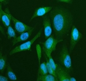 CD2AP Antibody / Cytoskeletal Adapter Protein Antibody HeLa Immunofluorescence. Immunofluorescent staining of FFPE human HeLa cells using CD2AP Antibody / Cytoskeletal Adapter Protein Antibody (green) with DAPI nuclear counterstain (blue). Heat-induced epitope retrieval was performed by steaming sections in pH 6.0 citrate buffer for 20 minutes prior to staining. Cells were incubated with the primary antibody at 5 ug/ml. CD2AP displays predominantly cytoplasmic staining, consistent with its role as a cytoskeletal adaptor protein that links membrane-associated signaling complexes to the actin cytoskeleton and regulates receptor trafficking and cell adhesion.