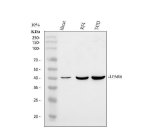 P2RY5 Antibody Human Cell WB. Western blot analysis of human HaCaT, RT4, and T47D cell lysates using P2RY5 Antibody. Lane 1: HaCaT whole cell lysate. Lane 2: RT4 whole cell lysate. Lane 3: T47D whole cell lysate. Samples (30 ug/lane) were separated on a 10% SDS-PAGE gel under reducing conditions, transferred to a nitrocellulose membrane, and detected with P2RY5 Antibody at 0.5 ug/mL followed by an HRP-conjugated secondary antibody and ECL detection. A specific band is observed at approximately 39 kDa, consistent with the predicted molecular weight of LPAR6/P2RY5. These results demonstrate that P2RY5 Antibody, a Lysophosphatidic Acid Receptor Antibody, specifically detects endogenous receptor expression in multiple human cell lines.
