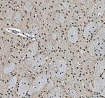 MRE11 Antibody Rat Brain IHC. Immunohistochemical staining of FFPE rat brain tissue using MRE11 antibody demonstrated predominantly nuclear staining in neuronal and glial cells, consistent with the role of MRE11 as a core component of the MRN complex responsible for DNA double-strand break detection and repair. Heat-induced epitope retrieval was performed in pH 8.0 EDTA buffer prior to staining. Tissue sections were blocked with 10% goat serum and incubated with the primary antibody (2 ug/ml) overnight at 4Â°C, followed by a peroxidase-conjugated goat anti-rabbit IgG secondary antibody. Immunoreactivity was visualized using an HRP Super Vision detection system with DAB as the chromogen. This MRE11 Antibody, also called a DNA Double-Strand Break Repair Protein Antibody, is useful for investigating genome stability, DNA damage response signaling, neurobiology, and MRN complex function.