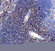 Immunohistochemical staining of FFPE mouse spleen tissue with CD80 antibody, HRP-secondary and DAB substrate. HIER: boil tissue sections in pH8 EDTA for 20 min and allow to cool before testing.