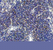 Immunohistochemical staining of FFPE rat spleen tissue with CD80 antibody, HRP-secondary and DAB substrate. HIER: boil tissue sections in pH8 EDTA for 20 min and allow to cool before testing.