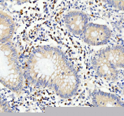 Immunohistochemical staining of FFPE human appendix tissue with CD80 antibody, HRP-secondary and DAB substrate. HIER: boil tissue sections in pH8 EDTA for 20 min and allow to cool before testing.