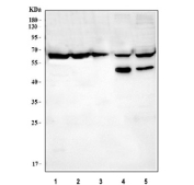 Western blot testing of 1) human Raji, 2) human Daudi, 3) human Ramos, 4) mouse thymus and 5) mouse RAW264.7 lysate with CD80 antibody. Instead of the ~33 kDa predicted size, CD80 is detected as a broad band between ~60-65 kDa, consistent with its known extensive N-linked glycosylation. Mouse samples display an additional lighter band at ~50 kDa, representing a less-glycosylated CD80 isoform commonly reported in immune tissues.