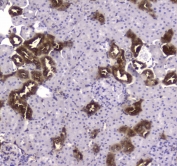 CKB Antibody Rat Kidney IHC. Immunohistochemistry testing of FFPE rat kidney tissue with CKB antibody at 1ug/ml. Required HIER: steam section in pH6 citrate buffer for 20 min and allow to cool prior to staining.