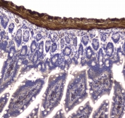 IHC testing of FFPE mouse small intestine tissue with MYLK antibody at 1ug/ml. Required HIER: steam section in pH6 citrate buffer for 20 min and allow to cool prior to staining.